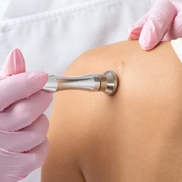 35. Organic Upper Arm Rejuvenation Treatment