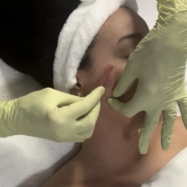 Dermaplaning Add On