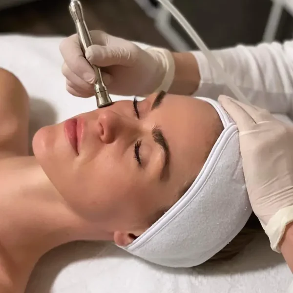 Microdermabrasion Add On