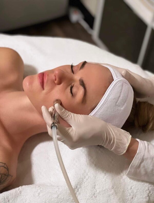 23.Add Microdermabrasion Service
