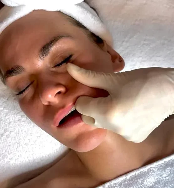 48. Buccal Facial